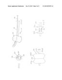 APPARATUS AND METHOD FOR AIDING ORGAN TREATMENT diagram and image