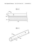 SYSTEMS AND METHODS FOR SHUNTING FLUID diagram and image