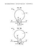 SYSTEMS AND METHODS FOR SHUNTING FLUID diagram and image