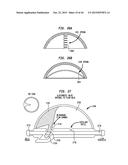 SYSTEMS AND METHODS FOR SHUNTING FLUID diagram and image