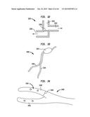 SYSTEMS AND METHODS FOR SHUNTING FLUID diagram and image