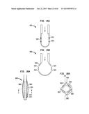 SYSTEMS AND METHODS FOR SHUNTING FLUID diagram and image