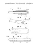 SYSTEMS AND METHODS FOR SHUNTING FLUID diagram and image