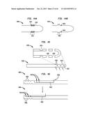 SYSTEMS AND METHODS FOR SHUNTING FLUID diagram and image