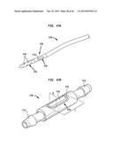 SYSTEMS AND METHODS FOR SHUNTING FLUID diagram and image