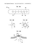 SYSTEMS AND METHODS FOR SHUNTING FLUID diagram and image