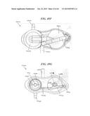 SYSTEMS AND METHODS FOR SHUNTING FLUID diagram and image