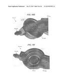 SYSTEMS AND METHODS FOR SHUNTING FLUID diagram and image