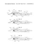 SYSTEMS AND METHODS FOR SHUNTING FLUID diagram and image