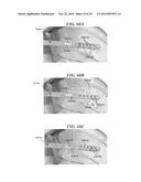 SYSTEMS AND METHODS FOR SHUNTING FLUID diagram and image