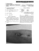 Ultrasonic Dispersion of Compositions in Tissue diagram and image