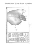 CLINICIAN PROGRAMMER SYSTEM AND METHOD FOR STEERING VOLUMES OF ACTIVATION diagram and image