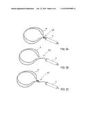 Leadless Cardiac Pacemaker with Secondary Fixation Capability diagram and image