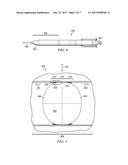 METHOD FOR FORMING A FABRIC PREFORM INSERT FOR A COMPOSITE TANK Y-JOINT diagram and image