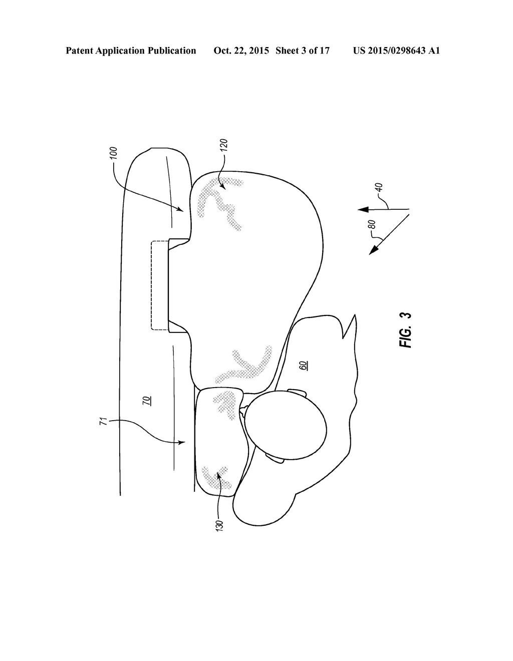 MULTI-CHAMBER AIRBAG WITH UNIDIRECTIONAL VENT - diagram, schematic, and image 04