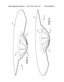 REVERSE-ACTING RUPTURE DISC WITH BUCKLING-CONTROL FEATURE diagram and image