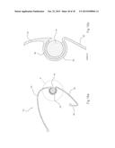 BIN LID CLOSING DEVICE diagram and image