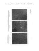 DEVELOPMENT OF HBV-AND/OR HDV-SUSCEPTIBLE CELLS, CELL LINES AND NON-HUMAN     ANIMALS diagram and image