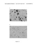 ANTIBODIES TO AMYLOID BETA diagram and image