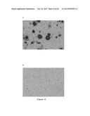 ANTIBODIES TO AMYLOID BETA diagram and image