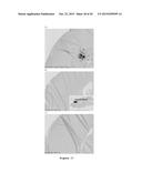 ANTIBODIES TO AMYLOID BETA diagram and image