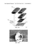 GRAPHENE BASED ELECTRODES AND APPLICATIONS diagram and image