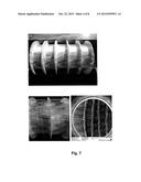 Endless Fibres on the Basis of Hyaluronan Selectively Oxidized in the     Position 6 of the N-Acetyl-D-Glucosamine Group, Preparation and Use     Thereof, Threads, Staples, Yarns, Fabrics Made Thereof and Method for     Modifying the Same diagram and image