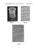 Endless Fibres on the Basis of Hyaluronan Selectively Oxidized in the     Position 6 of the N-Acetyl-D-Glucosamine Group, Preparation and Use     Thereof, Threads, Staples, Yarns, Fabrics Made Thereof and Method for     Modifying the Same diagram and image