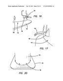 TRAFFIC CONE diagram and image