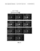 MODELS FOR PARKINSON S DISEASE STUDIES diagram and image