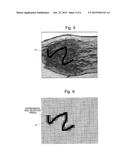 SYSTEM FOR SETTING ANALYSIS TARGET REGION diagram and image