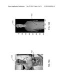 System and Method For Object Detection Using Structured Light diagram and image