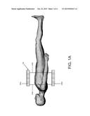 Method To Compensate Gating Effects On Image Uniformity And Quantification     For PET Scan With Continuous Bed Motion diagram and image