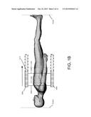 Method To Compensate Gating Effects On Image Uniformity And Quantification     For PET Scan With Continuous Bed Motion diagram and image