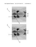 Method To Compensate Gating Effects On Image Uniformity And Quantification     For PET Scan With Continuous Bed Motion diagram and image