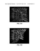 APPARATUS AND METHOD FOR PERFORMING MOTION CAPTURE USING A RANDOM PATTERN     ON CAPTURE SURFACES diagram and image