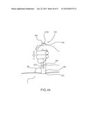 MEDICAL INJECTOR SIMULATION DEVICE diagram and image