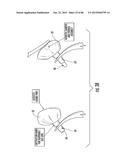 INFLATABLE EAR DEVICE diagram and image