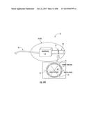 INFLATABLE EAR DEVICE diagram and image