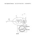 INFLATABLE EAR DEVICE diagram and image