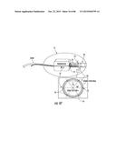 INFLATABLE EAR DEVICE diagram and image