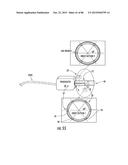 INFLATABLE EAR DEVICE diagram and image