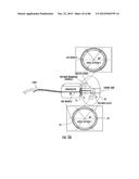 INFLATABLE EAR DEVICE diagram and image