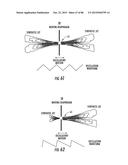 INFLATABLE EAR DEVICE diagram and image