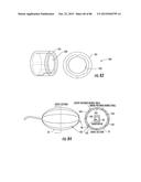 INFLATABLE EAR DEVICE diagram and image