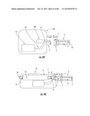 INFLATABLE EAR DEVICE diagram and image