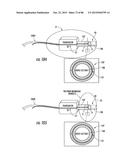 INFLATABLE EAR DEVICE diagram and image