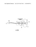 INFLATABLE EAR DEVICE diagram and image