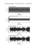 DISTORTION SOUND CORRECTION COMPLEMENT DEVICE AND DISTORTION SOUND     CORRECTION COMPLEMENT METHOD diagram and image