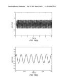 DISTORTION SOUND CORRECTION COMPLEMENT DEVICE AND DISTORTION SOUND     CORRECTION COMPLEMENT METHOD diagram and image